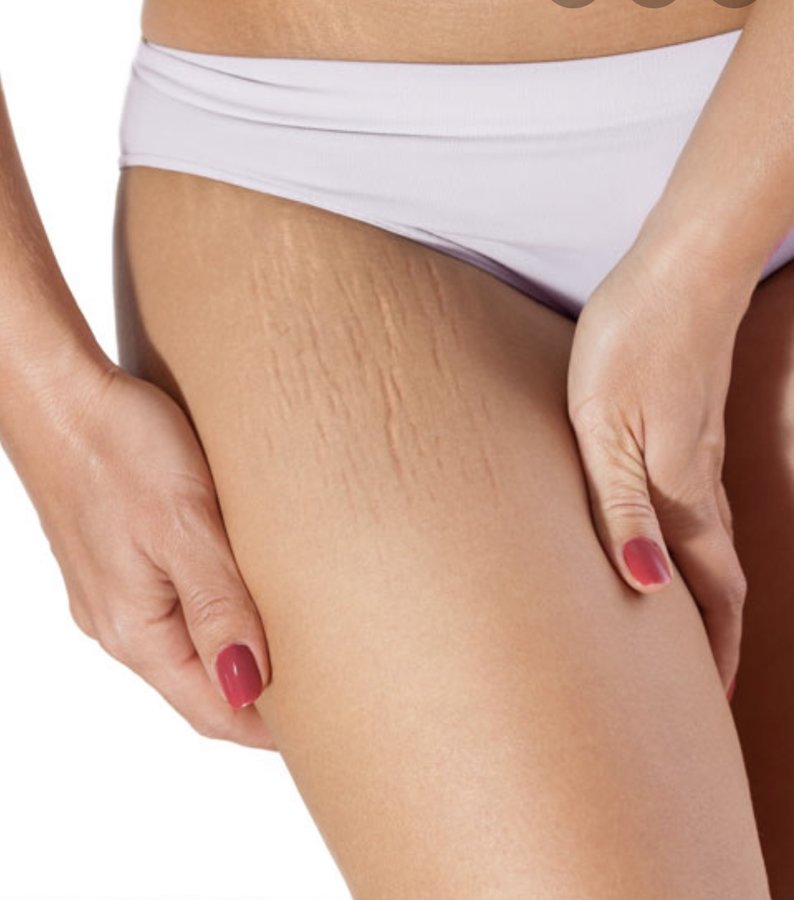 Suki Su Permanent Natural Makeup - Suki Su Permanent Natural Makeup