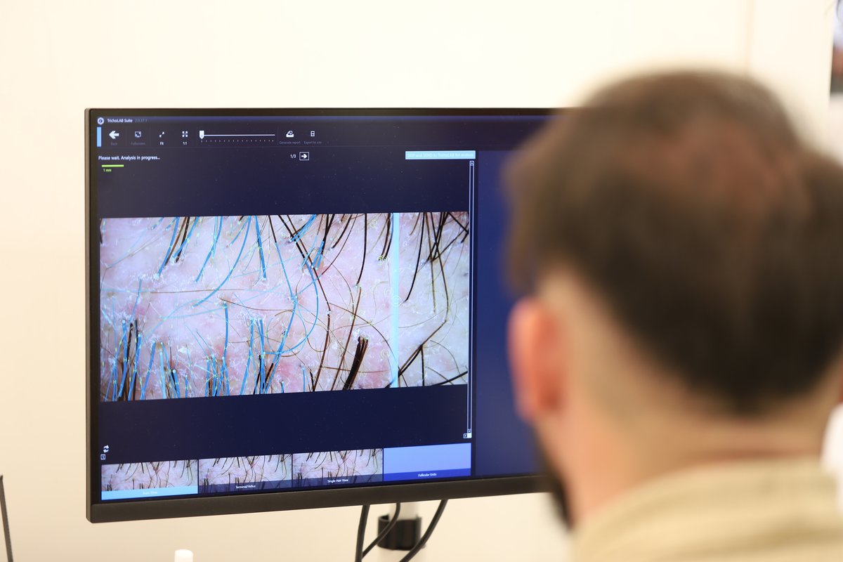 Sule Hair Transplant - Sule Hair Transplant