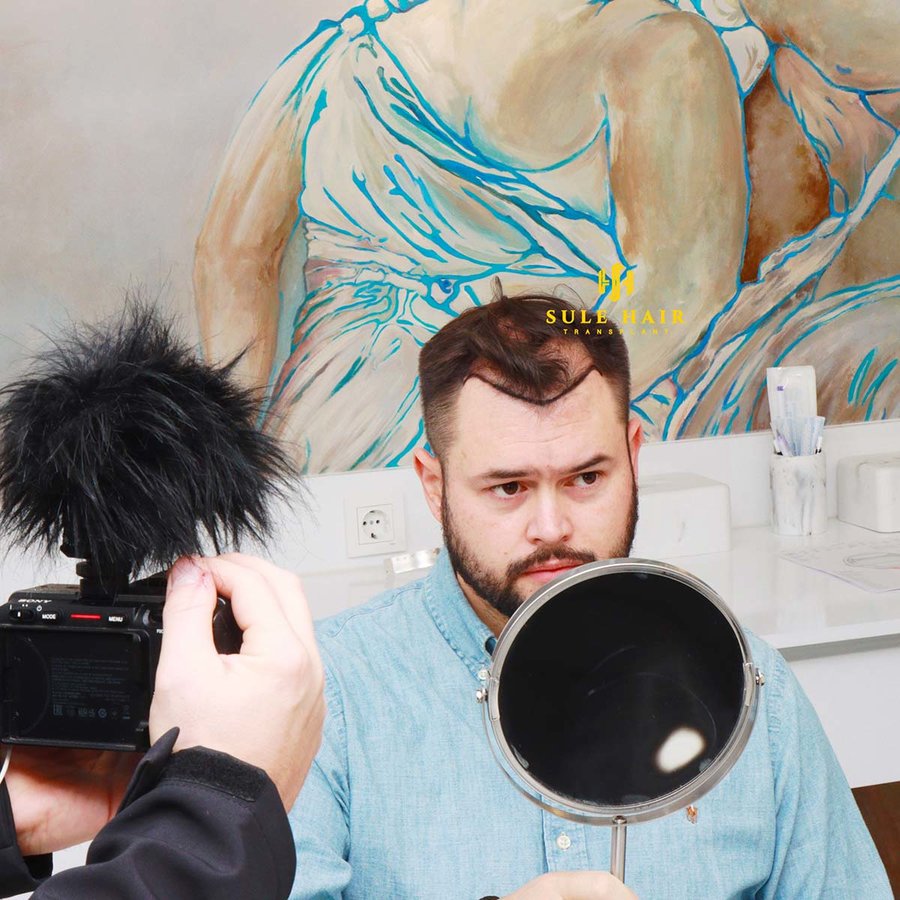 Sule Hair Transplant - Sule Hair Transplant