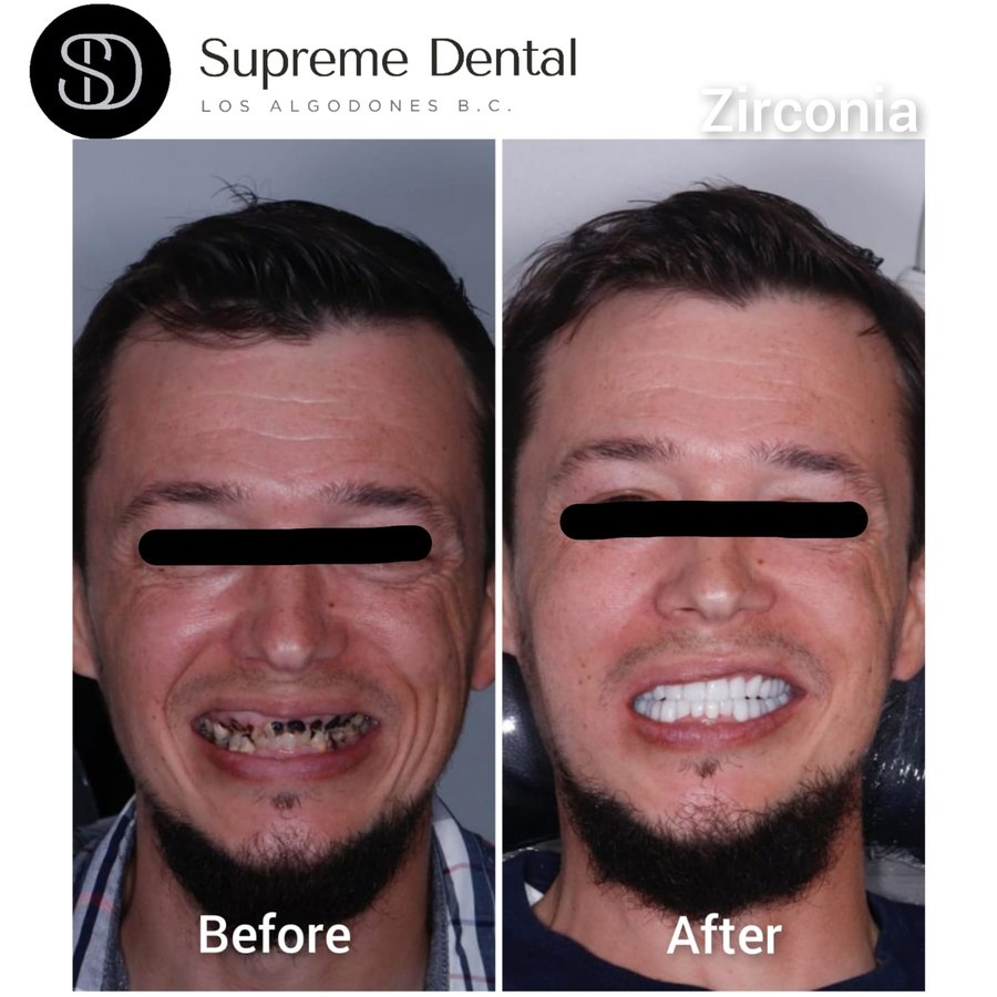 Supreme Dental Clinic - Supreme Dental Clinic