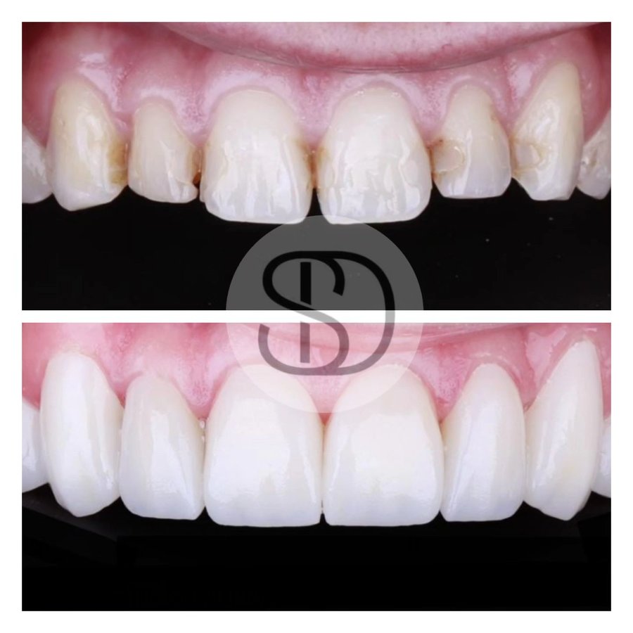 Supreme Dental Clinic - Supreme Dental Clinic