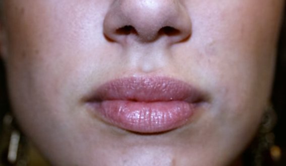 Surface Beauty Aesthetics Ltd - Surface Beauty Aesthetics Ltd