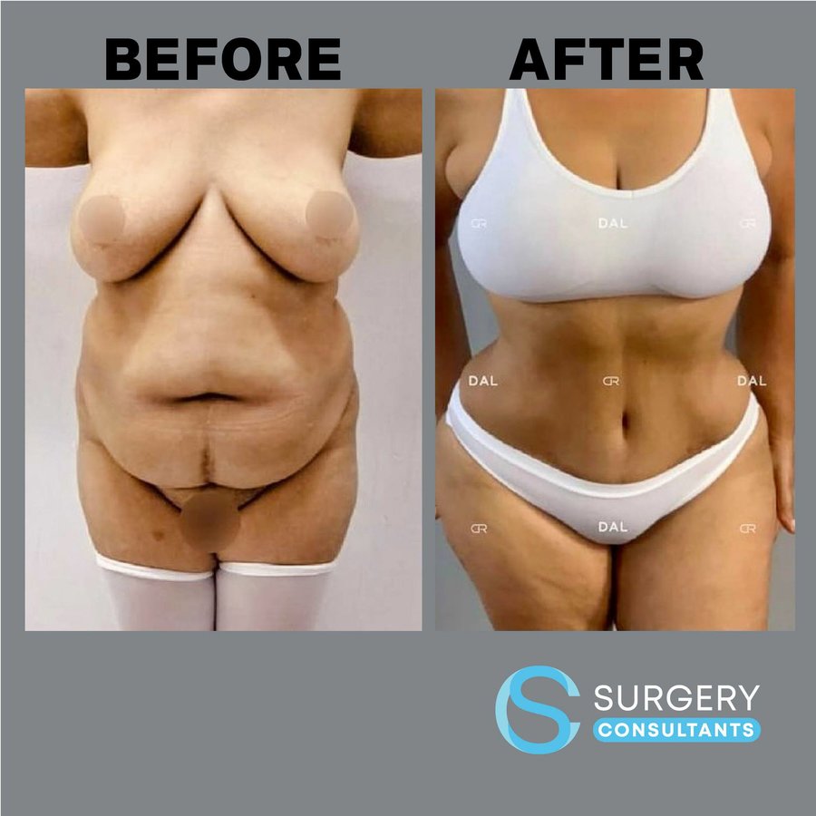 Surgery Consultants - Surgery Consultants