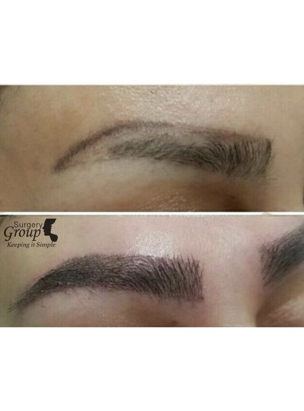 مجموعة الجراحة المحدودة هارلي ستريت - Surgery Group Ltd Harley Street