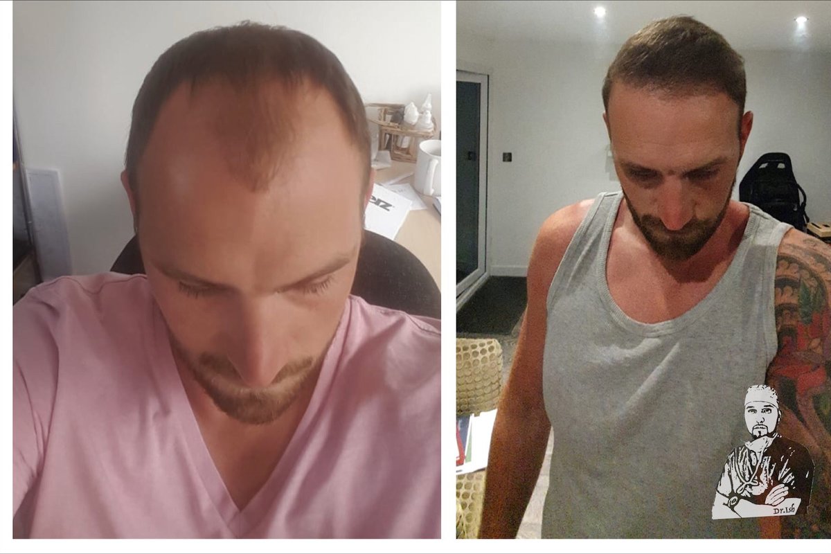 مجموعة الجراحة المحدودة هارلي ستريت - Surgery Group Ltd Harley Street