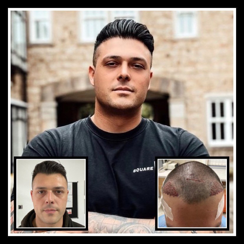 مجموعة الجراحة المحدودة هارلي ستريت - Surgery Group Ltd Harley Street