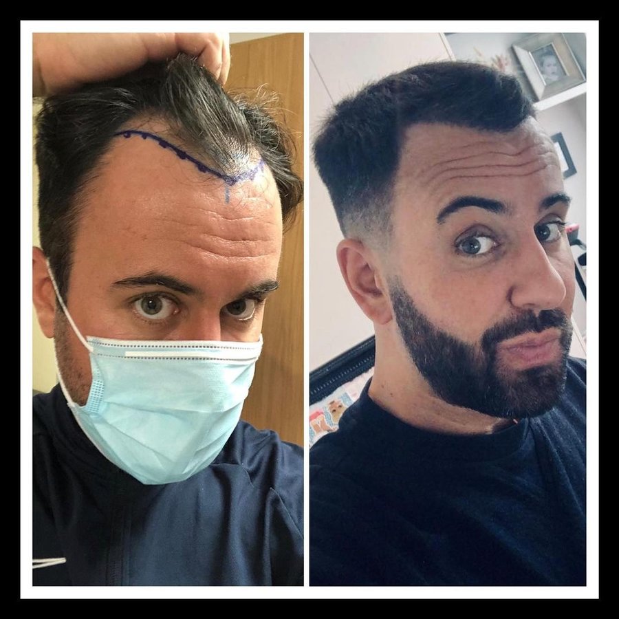 مجموعة الجراحة المحدودة هارلي ستريت - Surgery Group Ltd Harley Street