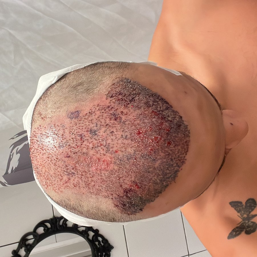 مجموعة الجراحة المحدودة هارلي ستريت - Surgery Group Ltd Harley Street