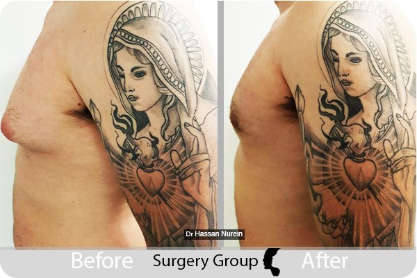 مجموعة الجراحة المحدودة هارلي ستريت - Surgery Group Ltd Harley Street
