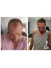 جراحة المجموعة المحدودة ليدز - Surgery Group Ltd Leeds