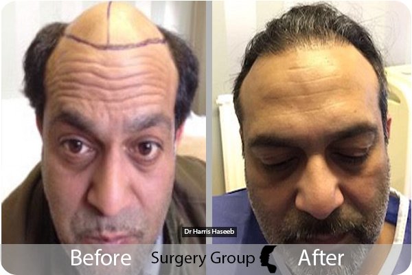 جراحة المجموعة المحدودة ليدز - Surgery Group Ltd Leeds