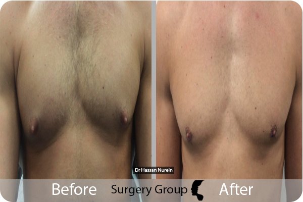 جراحة المجموعة المحدودة ليدز - Surgery Group Ltd Leeds