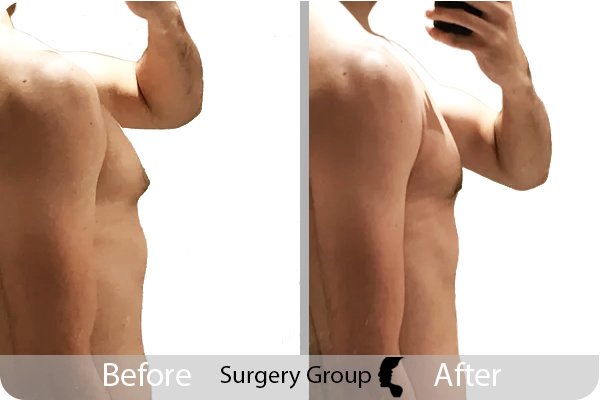 جراحة المجموعة المحدودة ليدز - Surgery Group Ltd Leeds
