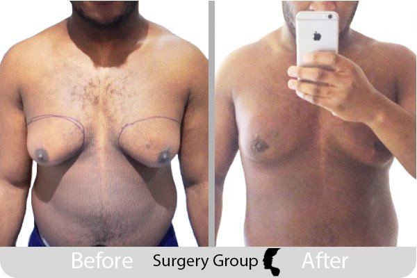 جراحة المجموعة المحدودة ليدز - Surgery Group Ltd Leeds