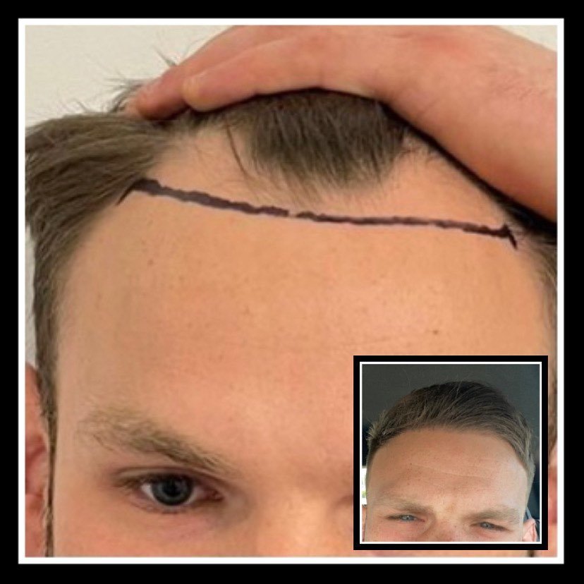 جراحة المجموعة المحدودة مانشستر - Surgery Group Ltd Manchester