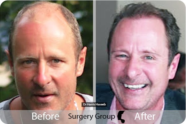 جراحة المجموعة المحدودة مانشستر - Surgery Group Ltd Manchester
