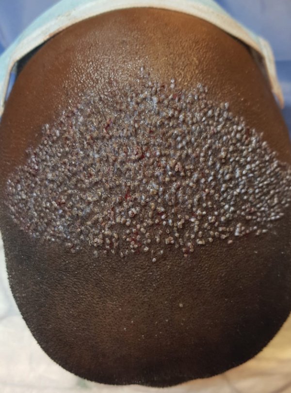 جراحة المجموعة المحدودة مانشستر - Surgery Group Ltd Manchester