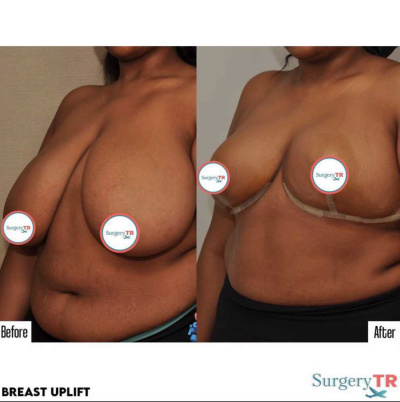 Surgery TR  - Surgery TR 