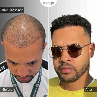 Surgery TR  - Surgery TR 