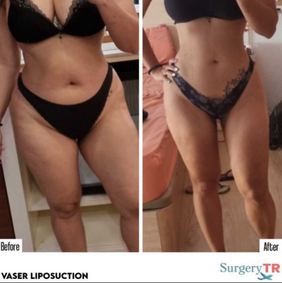 Surgery TR  - Surgery TR 