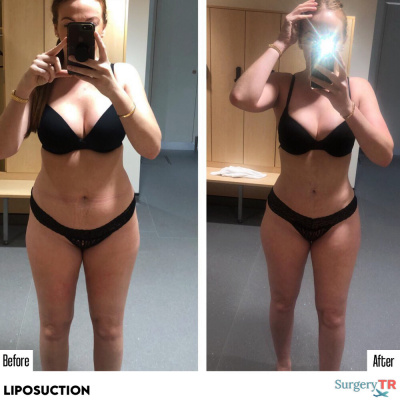 Surgery TR  - Surgery TR 