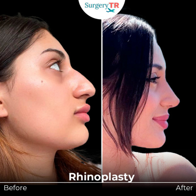 Surgery TR  - Surgery TR 