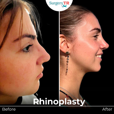 Surgery TR  - Surgery TR 