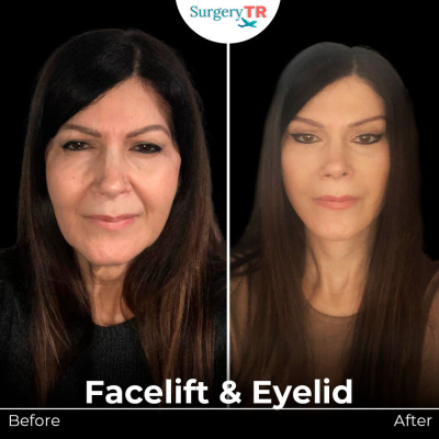 Surgery TR  - Surgery TR 