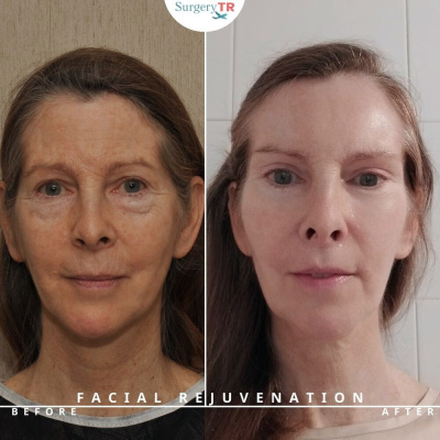 Surgery TR  - Surgery TR 