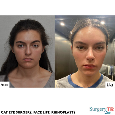 Surgery TR  - Surgery TR 