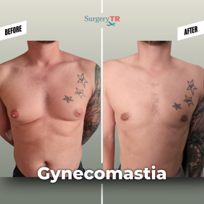 Surgery TR  - Surgery TR 