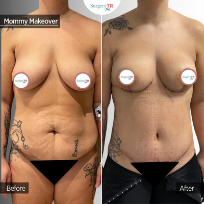 Surgery TR  - Surgery TR 