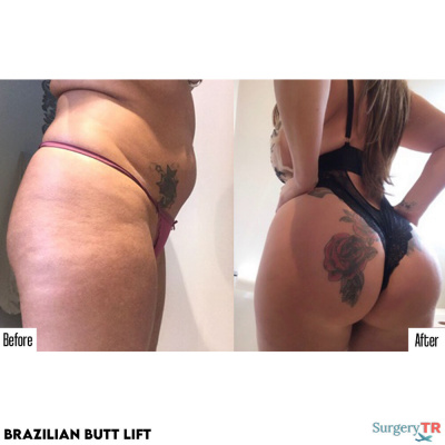 Surgery TR  - Surgery TR 