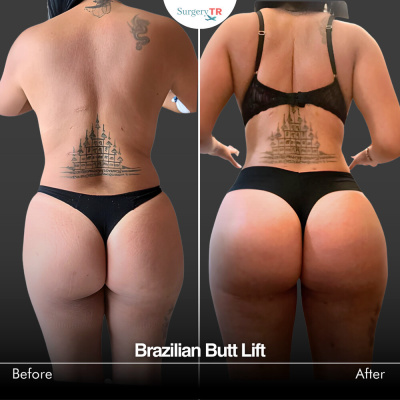 Surgery TR  - Surgery TR 