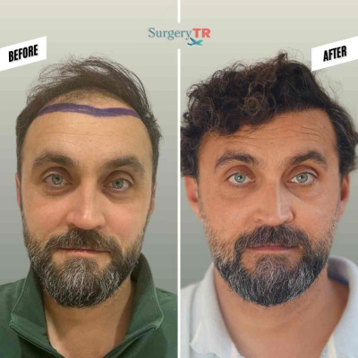 Surgery TR  - Surgery TR 