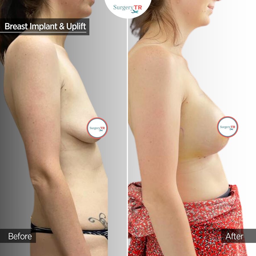 SurgeryTR - Istanbul - SurgeryTR - Istanbul