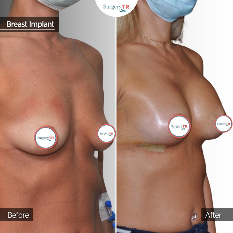 SurgeryTR - Istanbul - SurgeryTR - Istanbul