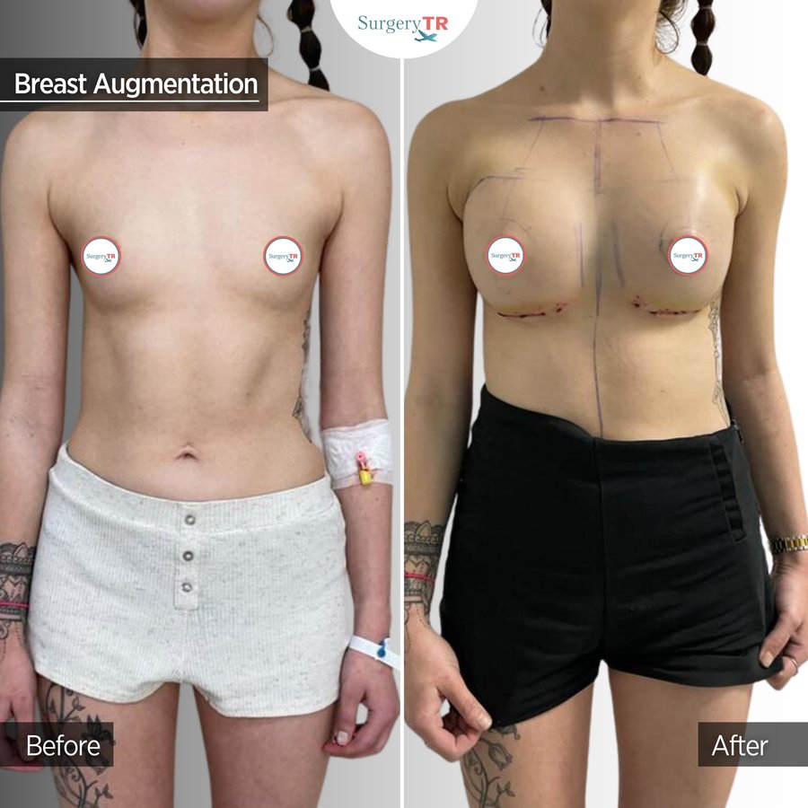 SurgeryTR - Istanbul - SurgeryTR - Istanbul