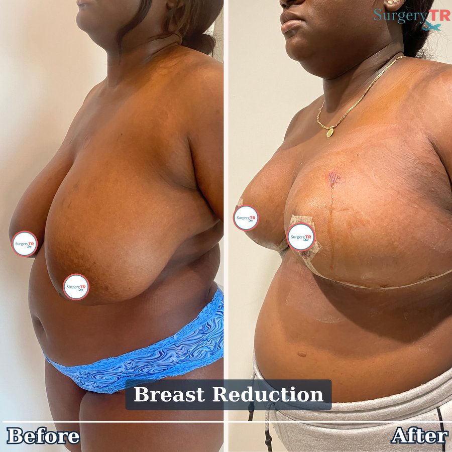 SurgeryTR - Istanbul - SurgeryTR - Istanbul