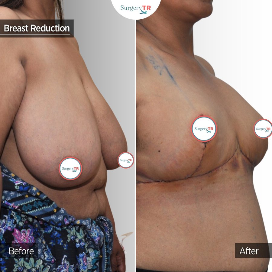 SurgeryTR - Istanbul - SurgeryTR - Istanbul