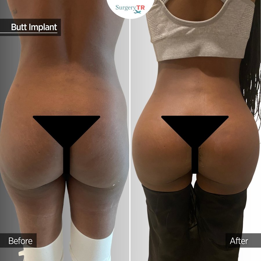 SurgeryTR - Istanbul - SurgeryTR - Istanbul