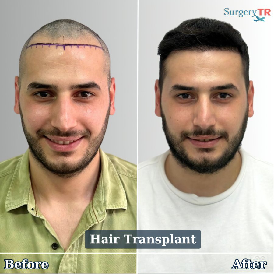 SurgeryTR - Istanbul - SurgeryTR - Istanbul