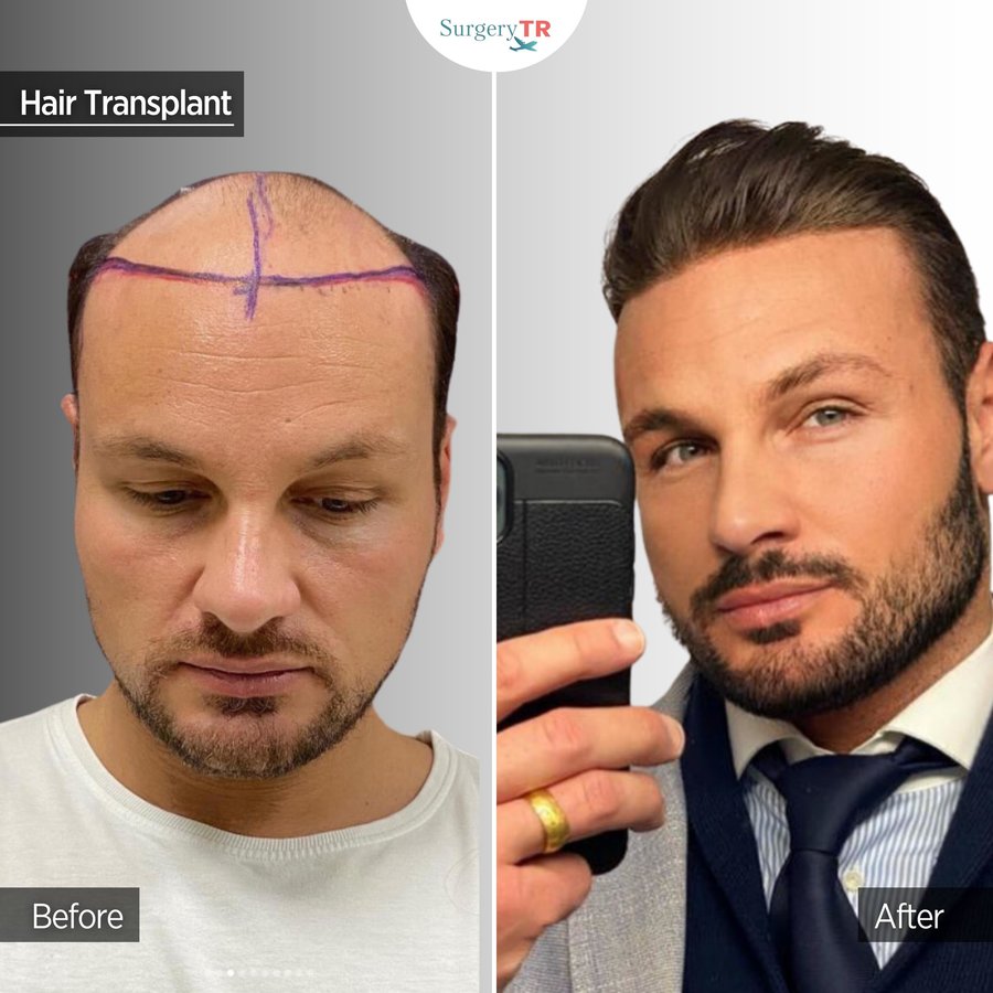 SurgeryTR - Istanbul - SurgeryTR - Istanbul