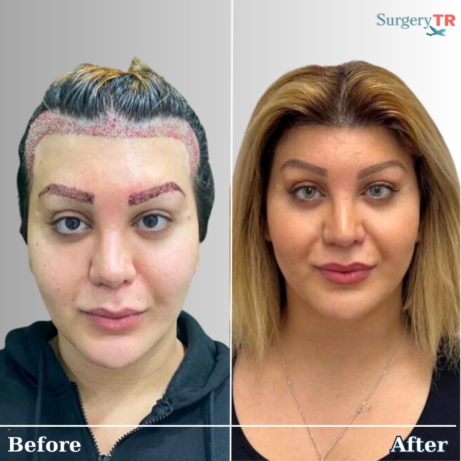 SurgeryTR - Istanbul - SurgeryTR - Istanbul