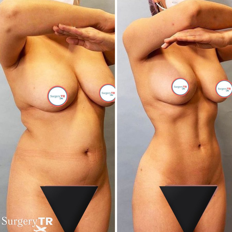 SurgeryTR - Istanbul - SurgeryTR - Istanbul