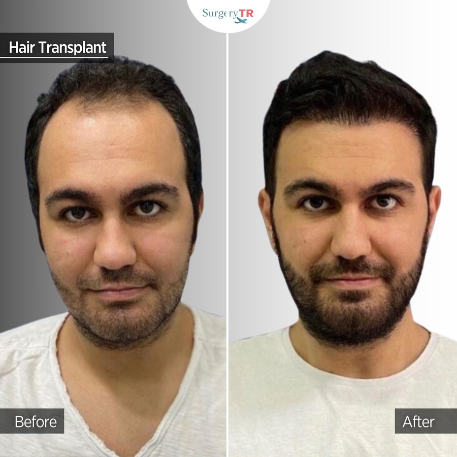 SurgeryTR - Istanbul - SurgeryTR - Istanbul