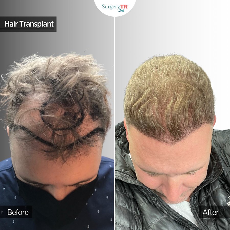 SurgeryTR - Istanbul - SurgeryTR - Istanbul