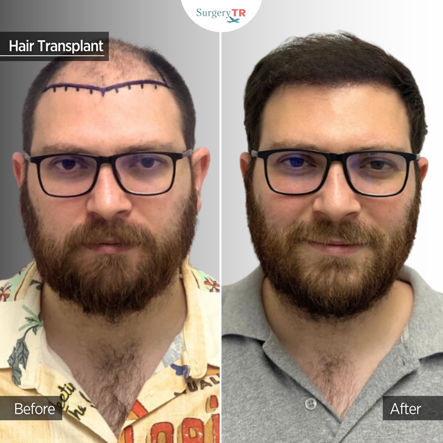 SurgeryTR - Istanbul - SurgeryTR - Istanbul