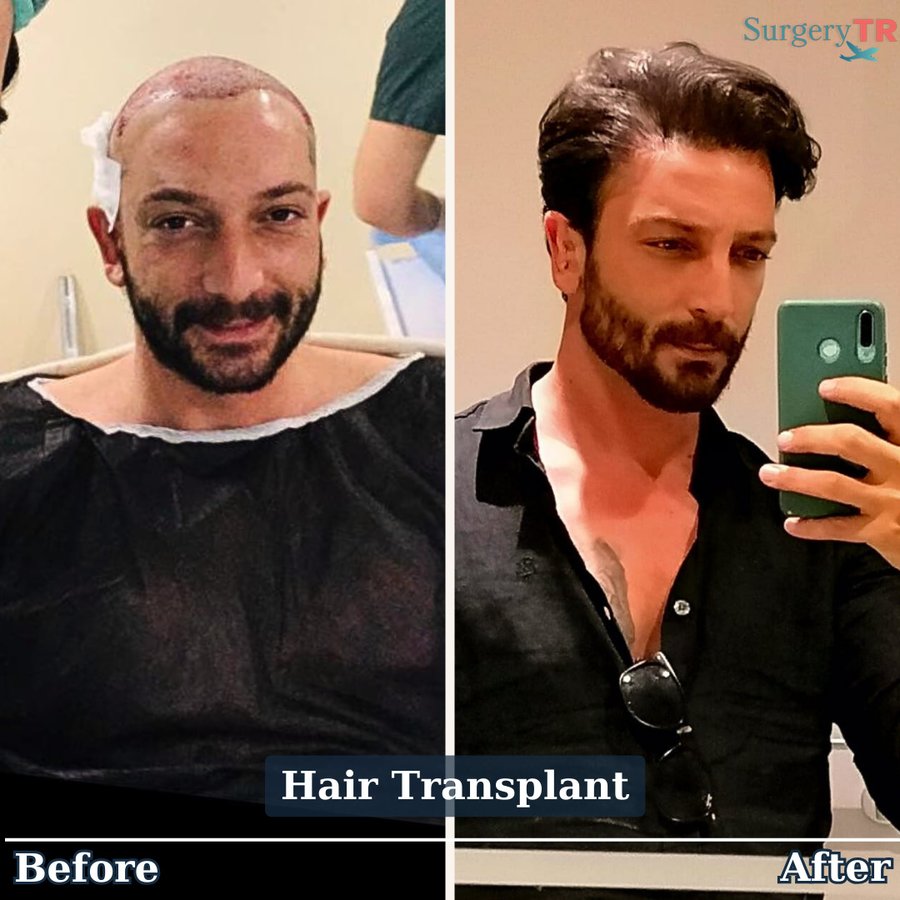 SurgeryTR - Istanbul - SurgeryTR - Istanbul