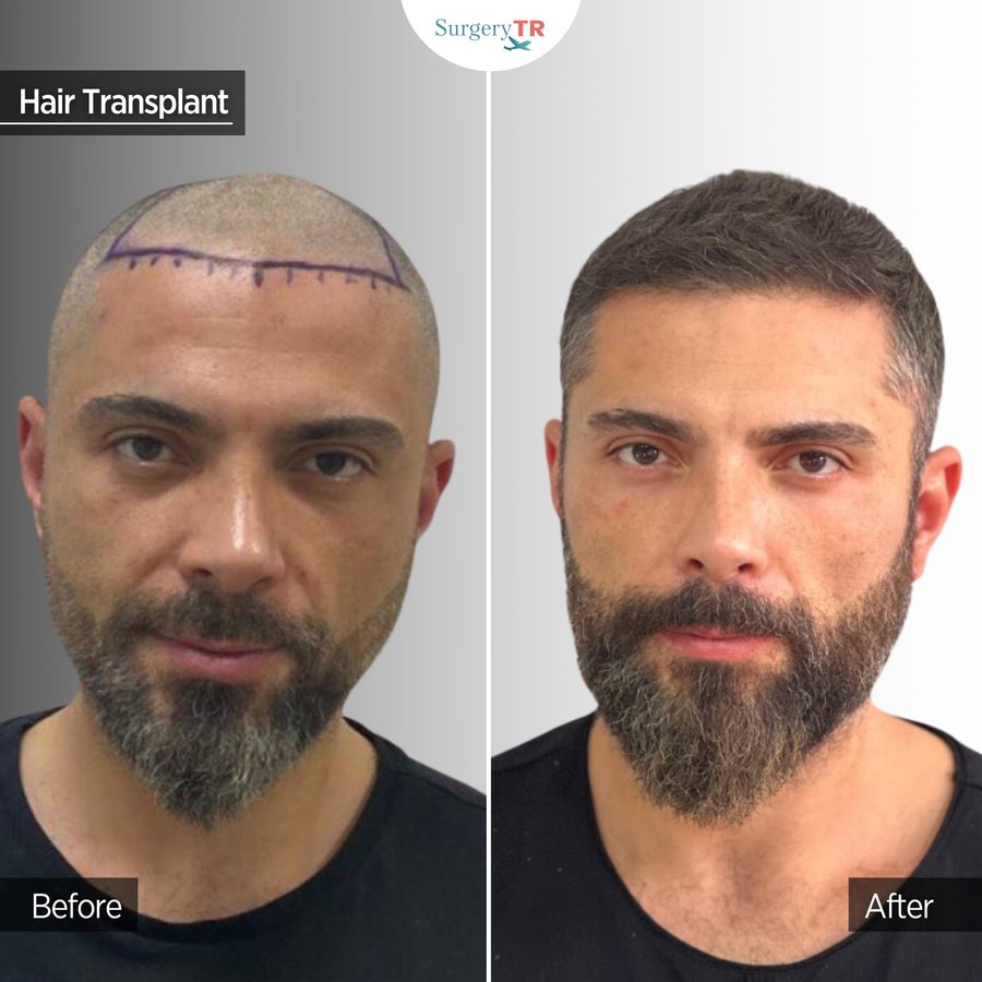 SurgeryTR - Istanbul - SurgeryTR - Istanbul